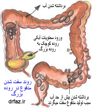 نتیجه تصویری برای یبوست