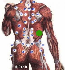 حجامت کبد حجامت های ناحیه تنه