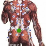 حجامت گودی کمر حجامت چهاربند الحجامه بین الورکین حجامت ساکرال حجامت رهاننده حجامت های ناحیه تنه