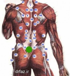 حجامت گودی کمر حجامت چهاربند الحجامه بین الورکین حجامت ساکرال حجامت رهاننده حجامت های ناحیه تنه