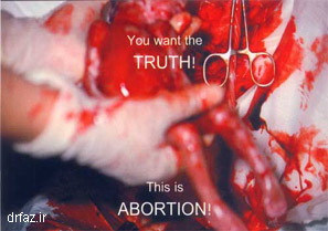 آموزش سقط جنین