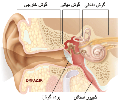 پارگی پرده گوش