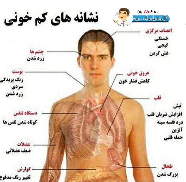 نشانه های کمخونی